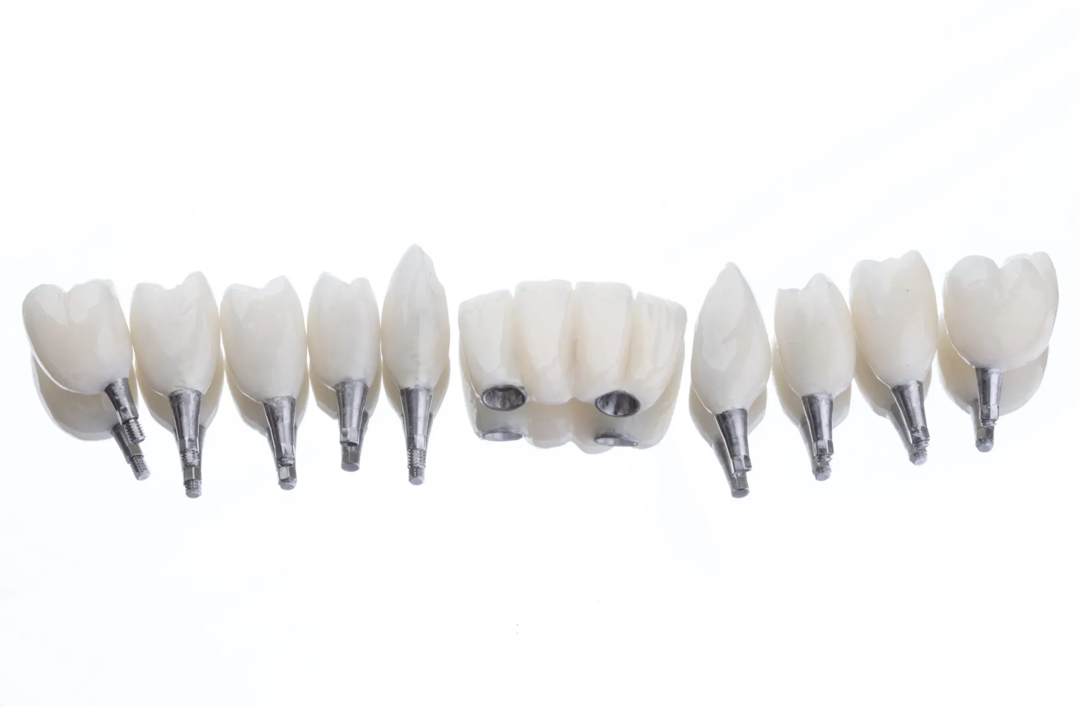 Dental Implant Crowns